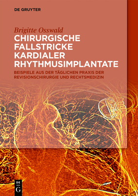 Chirurgische Fallstricke Kardialer Rhythmusimplantate: Beispiele Aus Der Täglichen PRAXIS Der Revisionschirurgie Und Rechtsmedizin - Brigitte Osswald