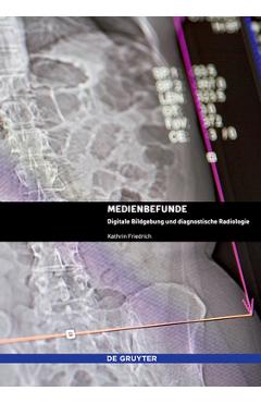 Coperta cărții 'Medienbefunde: Digitale Bildgebung Und Diagnostische Radiologie - Kathrin Friedrich'