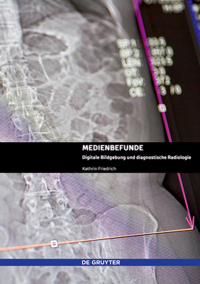 Coperta cărții 'Medienbefunde: Digitale Bildgebung Und Diagnostische Radiologie - Kathrin Friedrich'