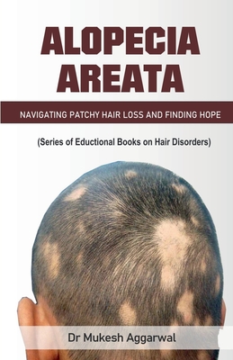 Alopecia Areata - Navigating Patchy Hair Loss