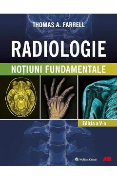 Coperta cărții 'Radiologie. Noțiuni fundamentale Ed.5 - Thomas A. Farrell'