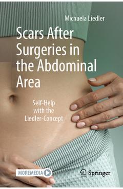 Coperta cărții 'Scars After Surgeries in the Abdominal Area: Self-Help with the Liedler-Concept - Michaela Liedler'