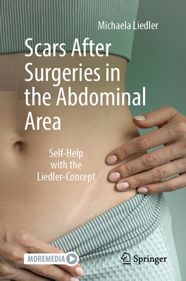 Scars After Surgeries in the Abdominal Area: Self-Help with the Liedler-Concept - Michaela Liedler