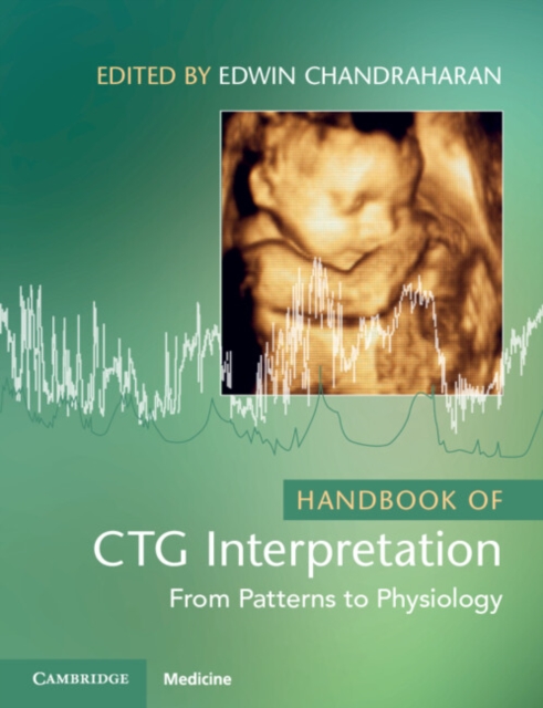 Coperta cărții 'Handbook of CTG Interpretation -'
