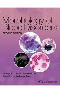 Poza produsului Morphology of Blood Disorders - Giuseppe D'onofrio