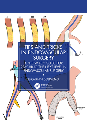 Tips and Tricks in Endovascular Surgery: A 