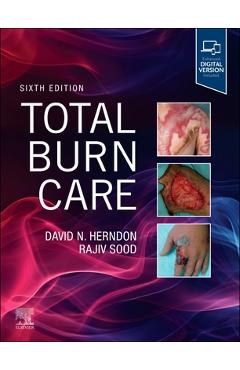 Coperta cărții 'Total Burn Care - David Herndon'