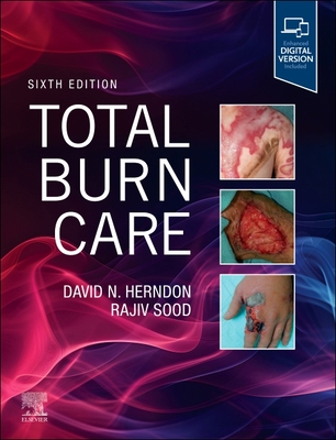 Coperta cărții 'Total Burn Care - David Herndon'