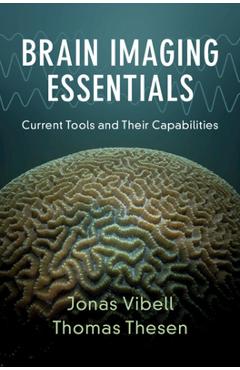 Coperta cărții 'Brain Imaging Essentials: Current Tools and Their Capabilities - Jonas Vibell'
