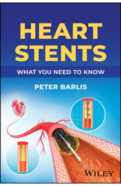 Coperta cărții 'Heart Stents: What You Need to Know - Peter Barlis'