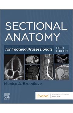 Poza produsului Sectional Anatomy for Imaging Professionals - Monica Breedlove