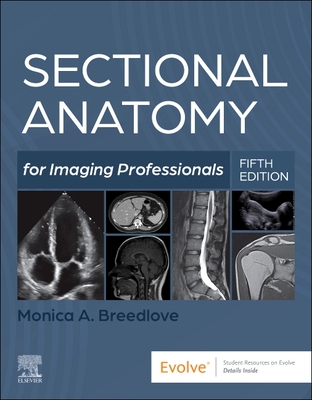 Coperta cărții 'Sectional Anatomy for Imaging Professionals - Monica Breedlove'