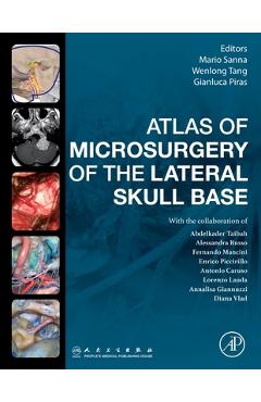 Coperta cărții 'Atlas of Microsurgery of the Lateral Skull Base - Mario Sanna'