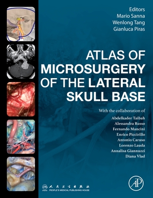 Coperta cărții 'Atlas of Microsurgery of the Lateral Skull Base - Mario Sanna'