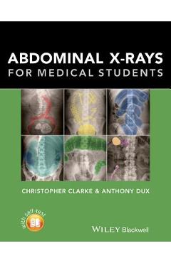 Coperta cărții 'Abdominal X-Rays for Medical Students - Christopher Clarke'