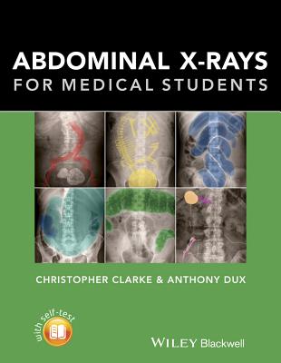 Coperta cărții 'Abdominal X-Rays for Medical Students - Christopher Clarke'