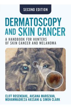 Coperta cărții 'Dermatoscopy and Skin Cancer, Second Edition - Cliff Rosendahl'