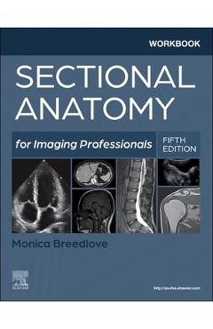 Coperta cărții 'Workbook for Sectional Anatomy for Imaging Professionals - Monica Breedlove'