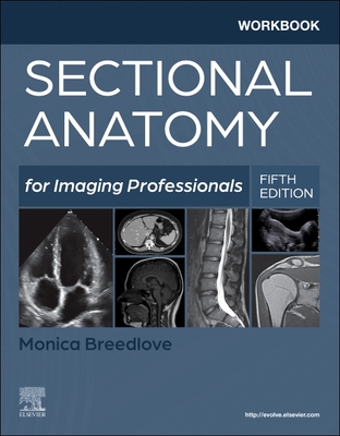 Coperta cărții 'Workbook for Sectional Anatomy for Imaging Professionals - Monica Breedlove'