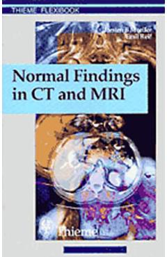 Coperta cărții 'Normal Findings in CT and Mri, A1, Print - Torsten Bert Möller'