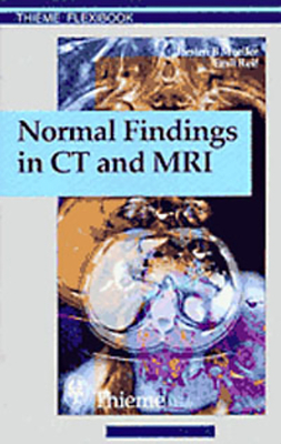 Coperta cărții 'Normal Findings in CT and Mri, A1, Print - Torsten Bert Möller'