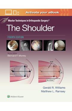 Coperta cărții 'Master Techniques in Orthopaedic Surgery: The Shoulder: Print + eBook with Multimedia - Gerald R. Williams'