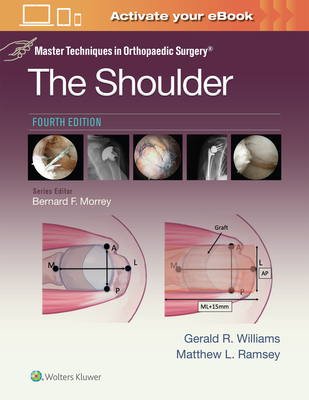 Coperta cărții 'Master Techniques in Orthopaedic Surgery: The Shoulder: Print + eBook with Multimedia - Gerald R. Williams'
