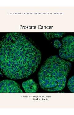 Coperta cărții 'Prostate Cancer - Michael Shen'