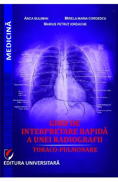 Coperta cărții 'Ghid de interpretare rapidă a unei radiografii toraco-pulmonare - Anca Buliman, Mirela Maria Coroescu, Marius Petruț'