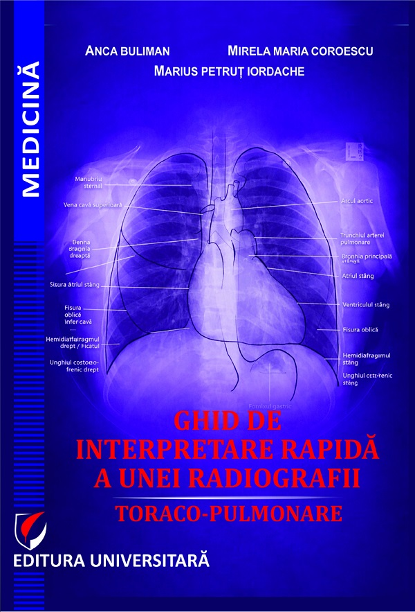 Coperta cărții 'Ghid de interpretare rapidă a unei radiografii toraco-pulmonare - Anca Buliman, Mirela Maria Coroescu, Marius Petruț'