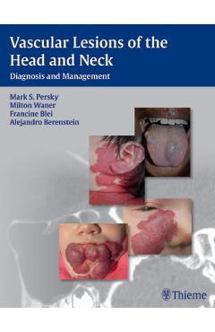 Coperta cărții 'Vascular Lesions of the Head and Neck: Diagnosis and Management - Mark S. Persky'
