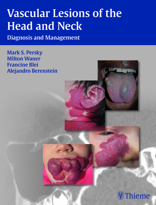 Coperta cărții 'Vascular Lesions of the Head and Neck: Diagnosis and Management - Mark S. Persky'