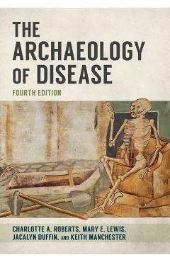 Coperta cărții 'Archaeology of Disease - Charlotte|manchester Roberts'