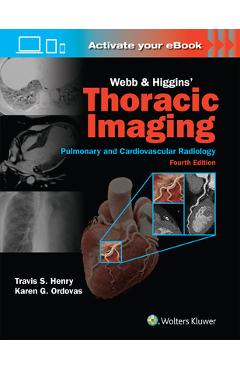 Coperta cărții 'Webb & Higgins Thoracic Imaging: Print + eBook with Multimedia - Travis Scott Henry'