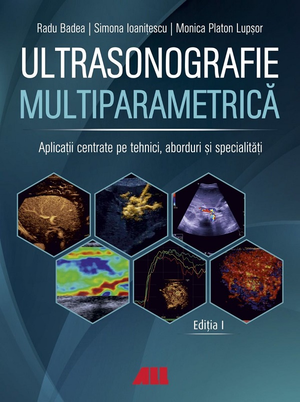 Coperta cărții 'Ultrasonografie multiparametrică - Radu Badea'