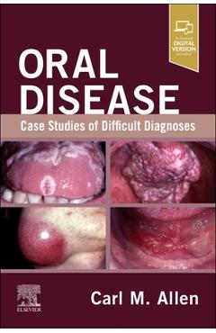 Coperta cărții 'Oral Disease: Case Studies of Difficult Diagnoses: Case Studies of Difficult Diagnoses - Carl M. Allen'