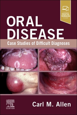 Coperta cărții 'Oral Disease: Case Studies of Difficult Diagnoses: Case Studies of Difficult Diagnoses - Carl M. Allen'