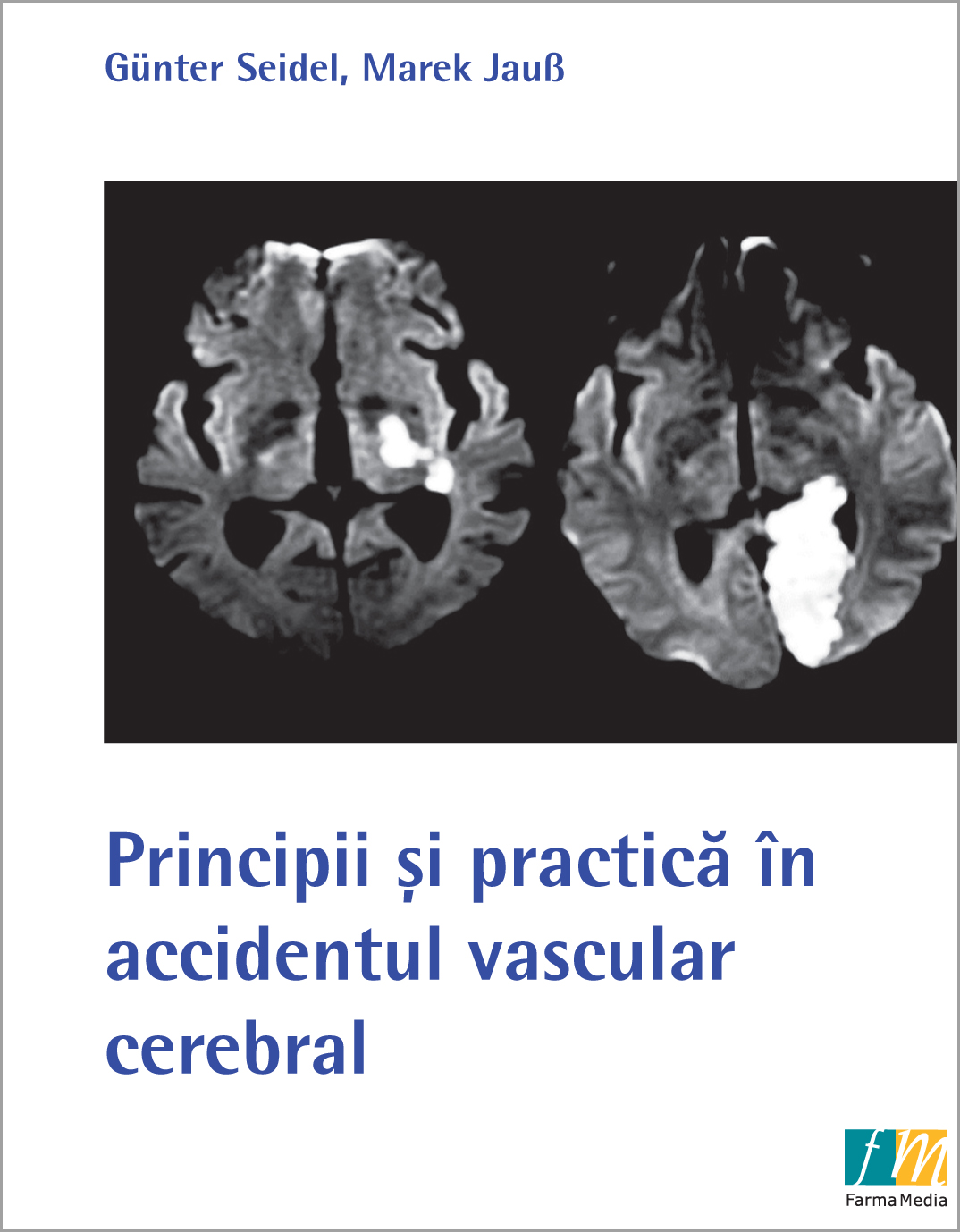 Principii si practica in accidentul vascular cerebral - Gunter Seidel, Marek Jaus