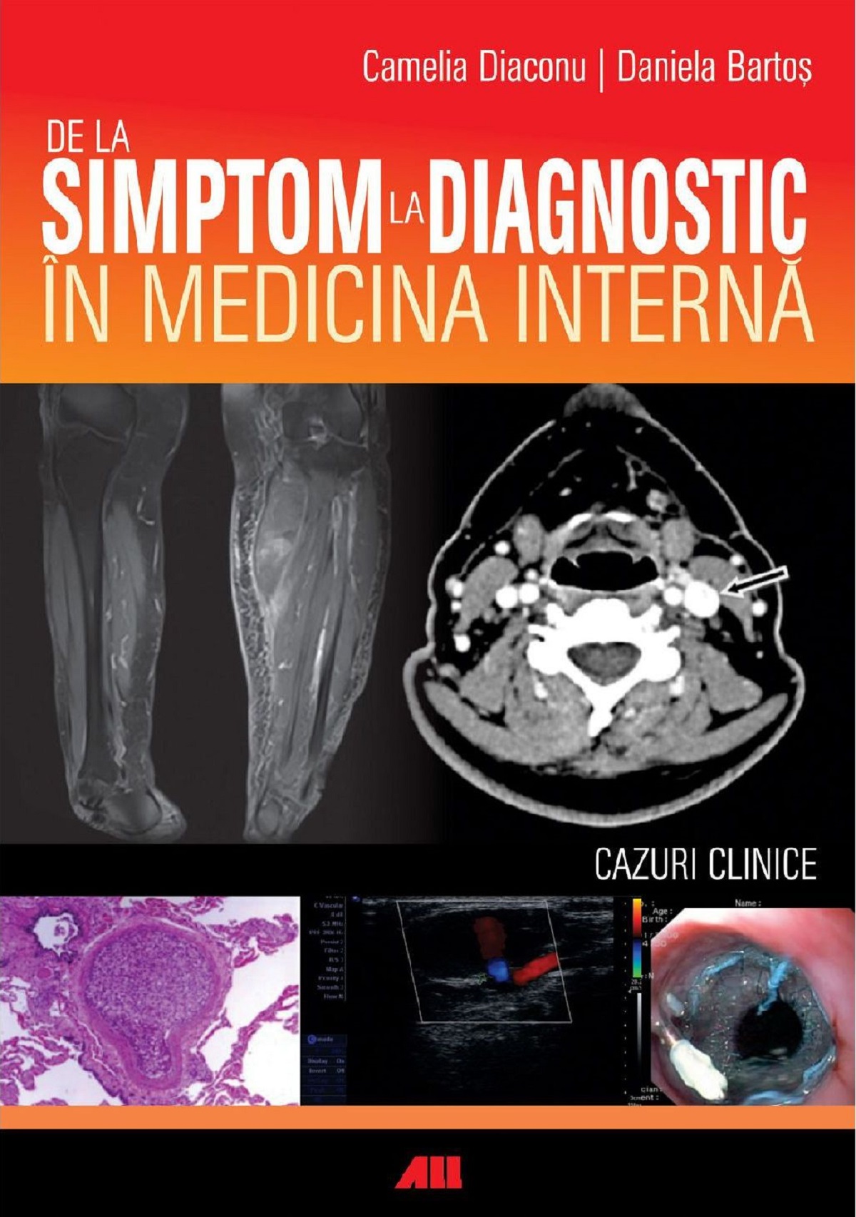 De la simptom la diagnostic in medicina interna - Camelia Diaconu, Daniela Bartos