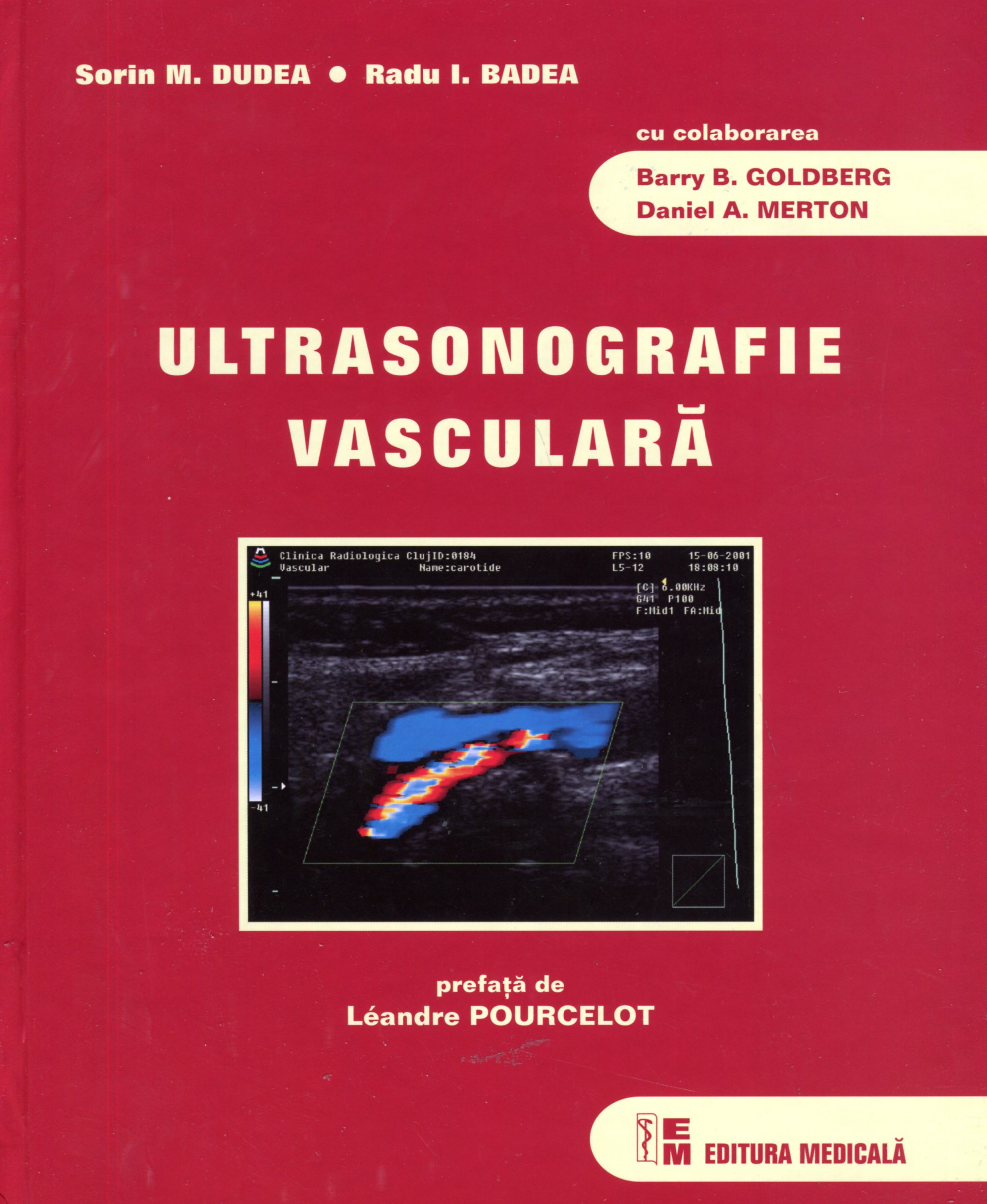 Ultrasonografie Vasculara - Sorin M. Dudea, Radu I. Badea